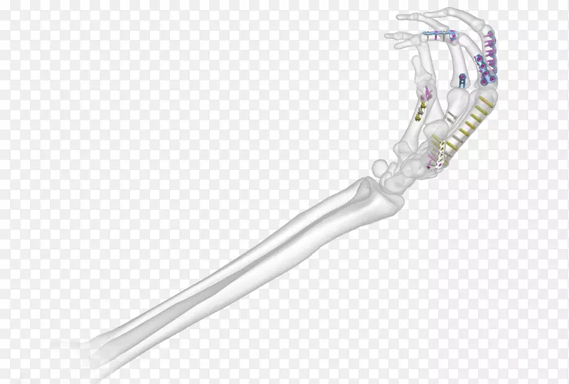 ��������.��˿-������