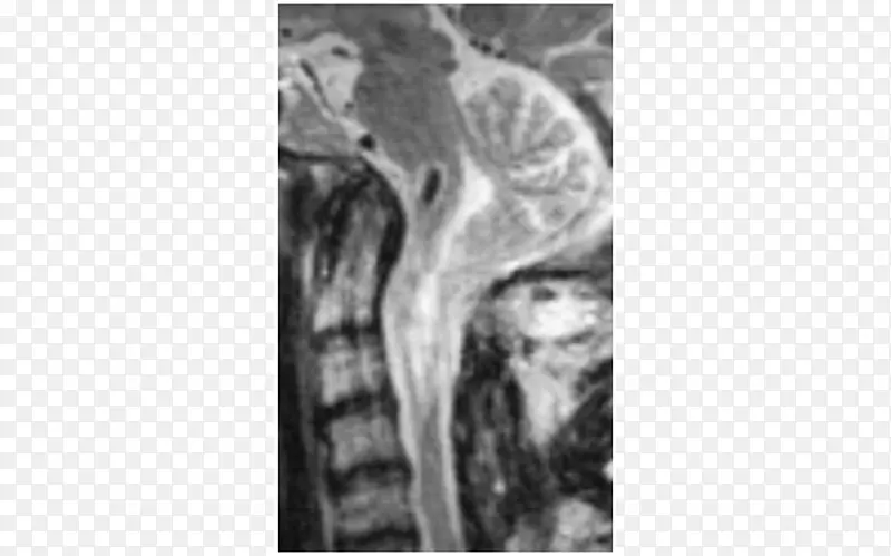 ��ɫ��Ӱ��ͼ.����ϸ��-������