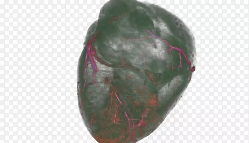 ��ʯ����ҽѧ-������