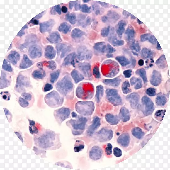 ������ϵ��Ѫ��-������