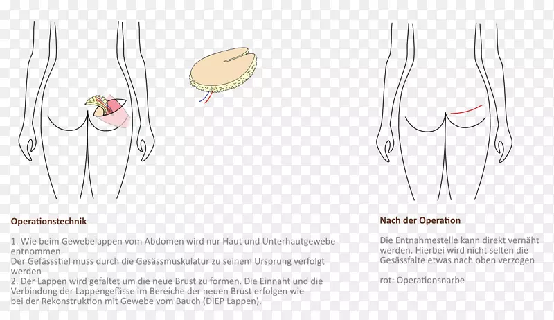 ֽƽ�����Ƥ�����-������