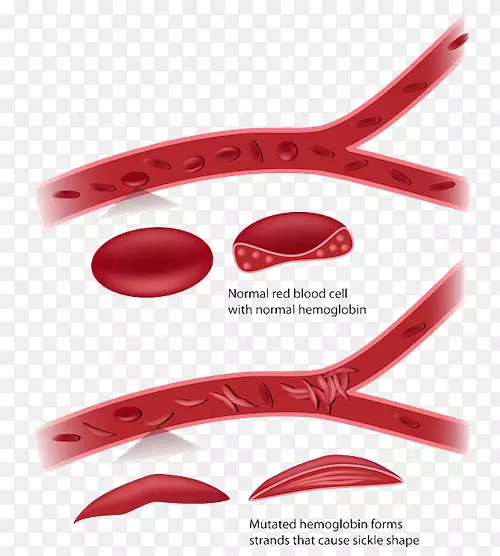 ��״ϸ������ϸ��ƶѪ����-������