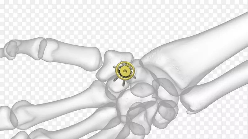 Ĵָ��ģ�������-������