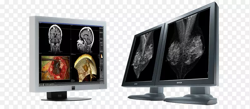 lcd���ӵ�����ʾ��Һ����ʾ��barco coronis 5mp ips������ʾ��-������