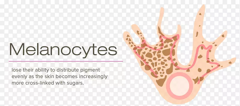 ����ϸ����ɫ��ϸ������ɫ���ʸ�˹ϸ��-������