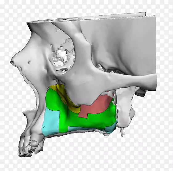 ���������-������