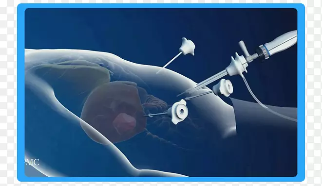 ��ǻ���������ư�֢-?����?-�ھ��±��ھ�����-������