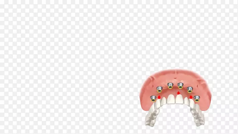 ȫ��4��������.���-������