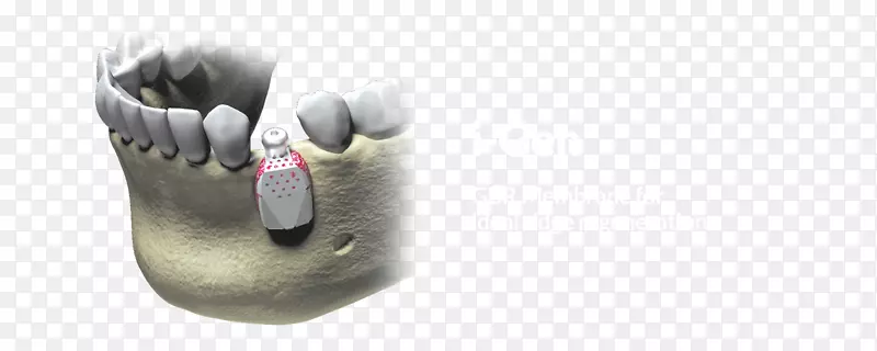 Case 123���Ĥ�������-������