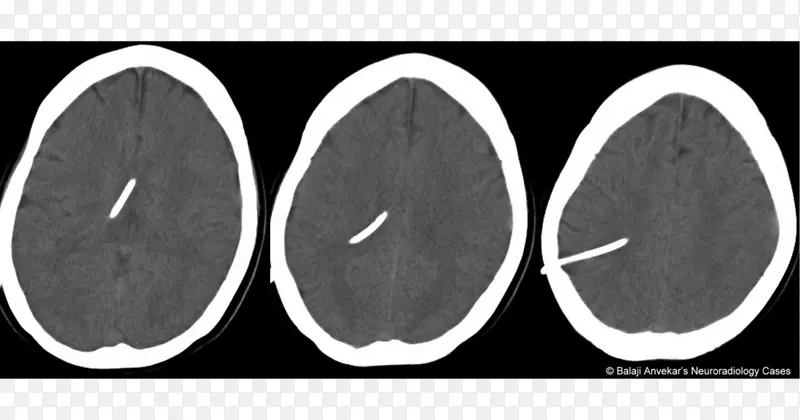 ���԰�ɫ����-������