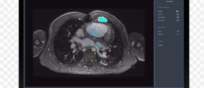 Amazon.com����ѷ�������ҵ��֢������ϲ�ɨ��-�Ź����������-������