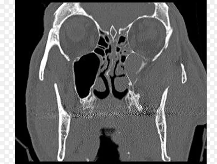 l ketieteellinen r ntgenkuvaus��X����Ӱ-����-������