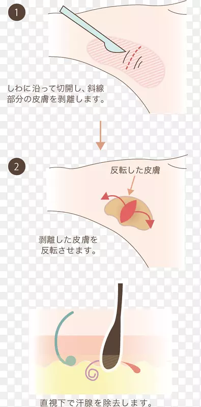 ֽ���������-������