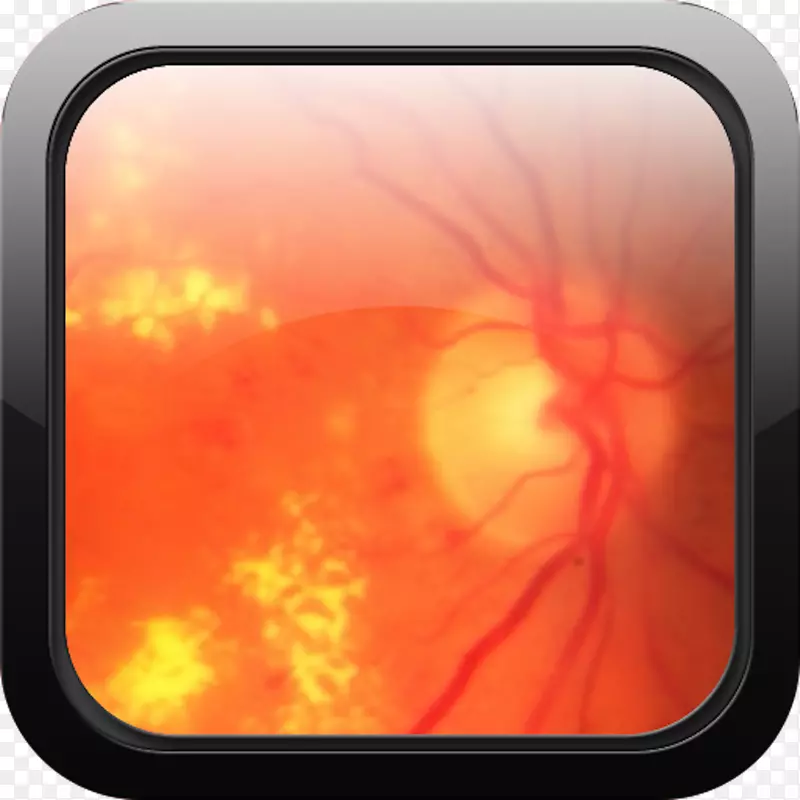 ̨ʽ��ֽ����-������