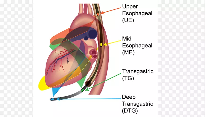 �������-������