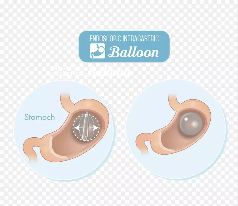 ���������-������