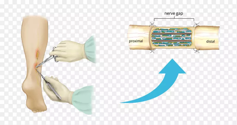 ��ˢ-������