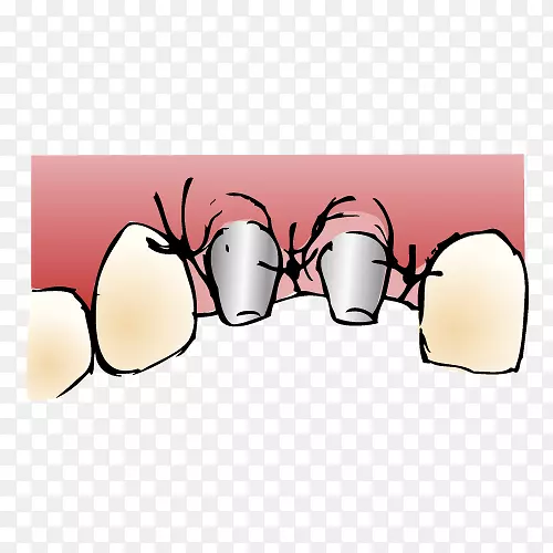 ��ͨ��ָ����-��ֲ��-������