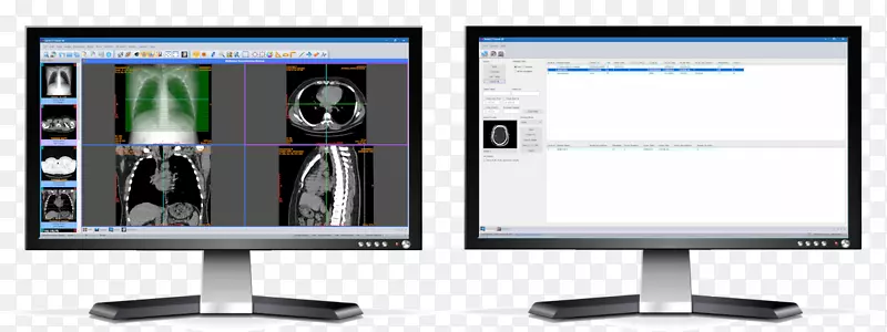 ������ʾ�����װ����ʾװ��ƽ����ʾ������ʾ����������ʾ��-������