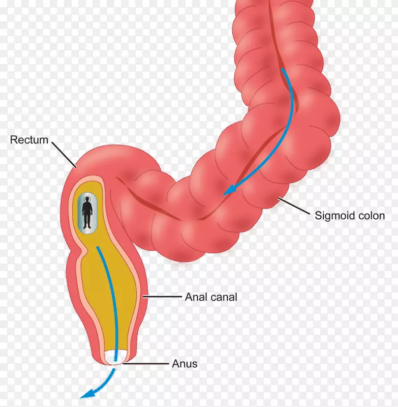 ��򢼡�����-������