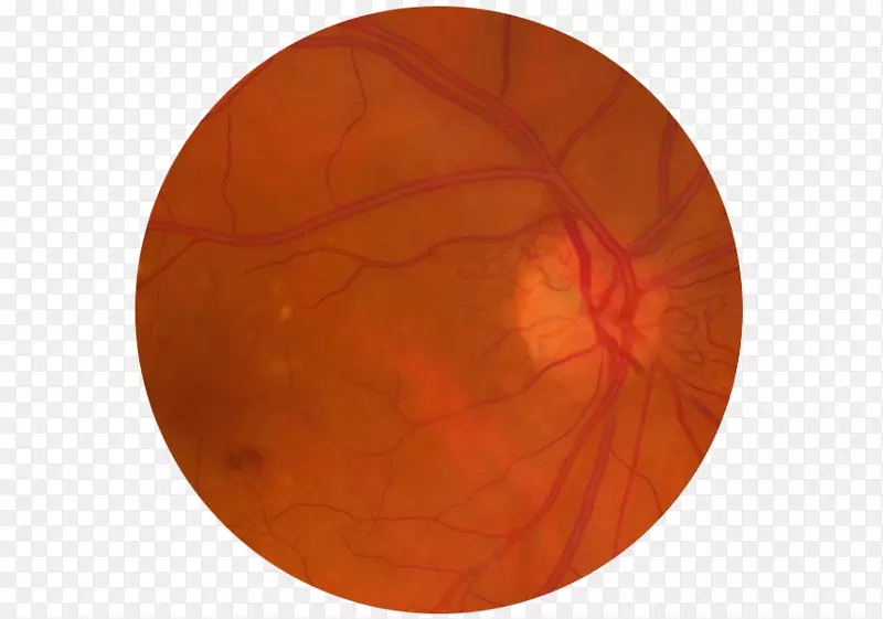 ԲȦ-������