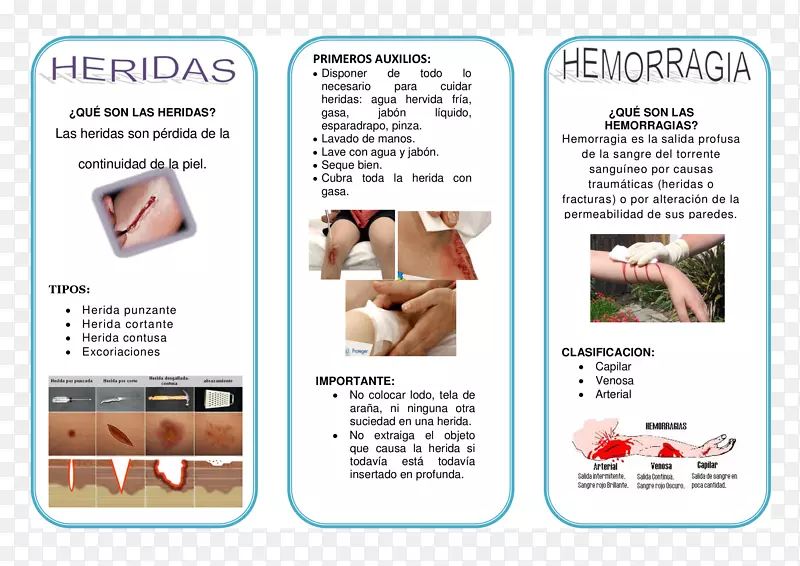 �����ָ�ֲ�.���-������