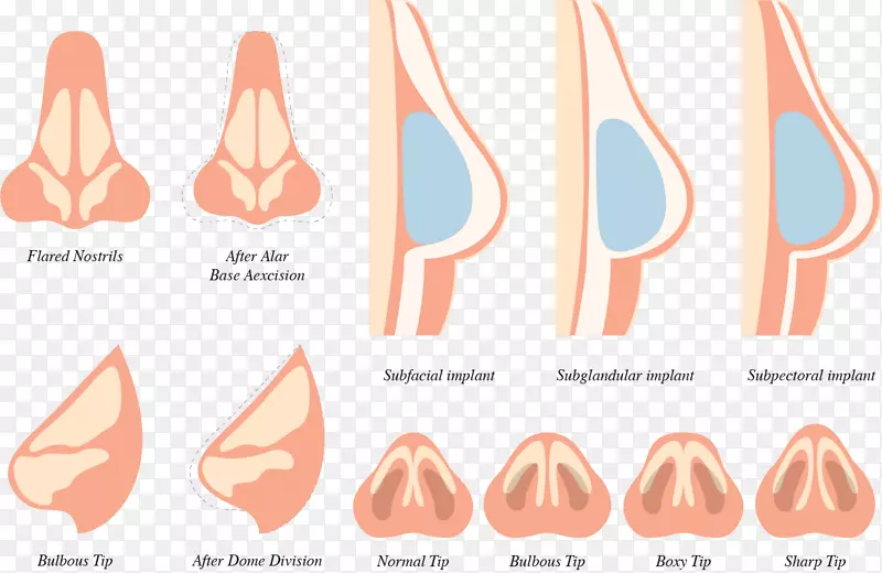 ������ŷʽ-��ͬ�ı���-������