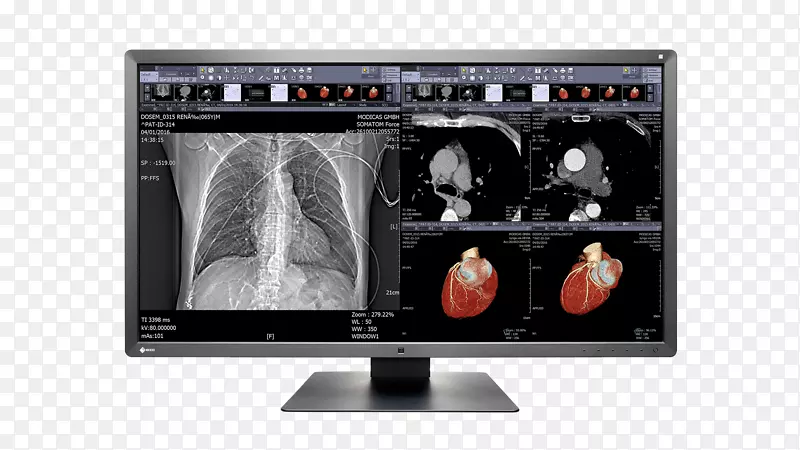 ������ʾ��Eizo������mx 242w 4k�ֱ��ʰ�������-������