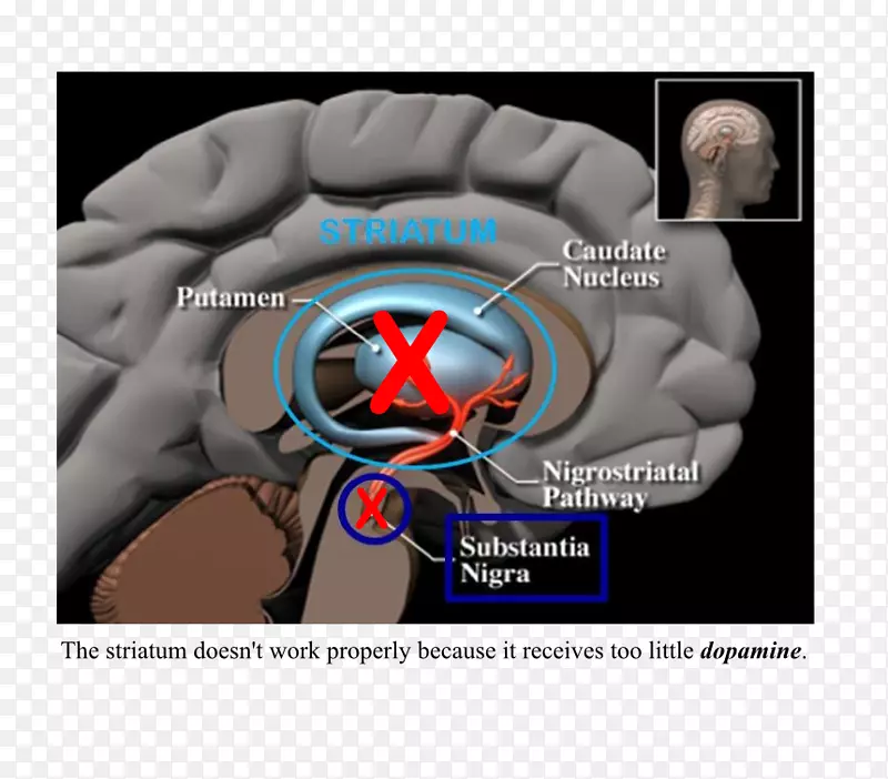 ����ɭ���������ư����ĺ�Ĭ��-������