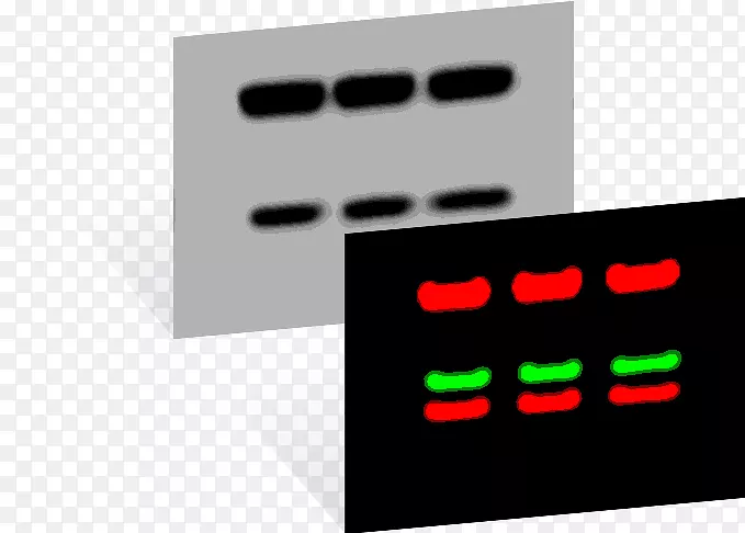 Westernblot�ߵ��ӽ��Ϸ�ӡ����-cor�����ѧ-������