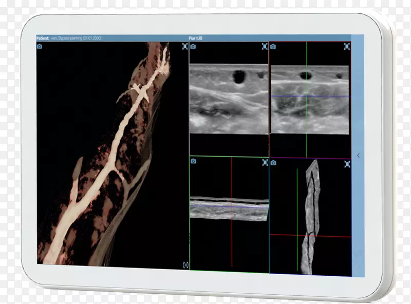 ������ý�弼��-������