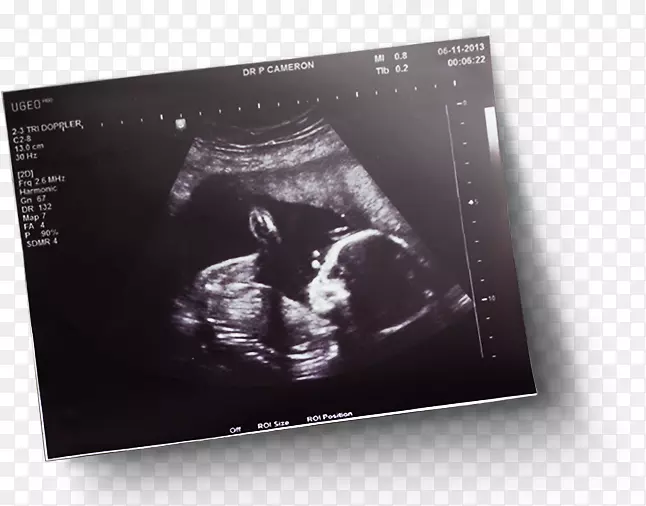 Ʒ�Ƴ���-������