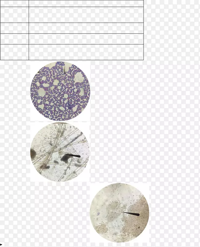 �Ͷ�˹&����Ȧ��ťȦ-������