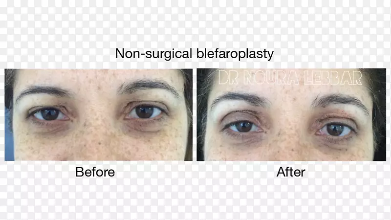 ��ë���죬�°ͣ���գ�üë����ͷ-����-������