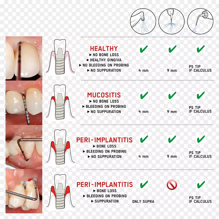 Ʒ����ָ�������-������