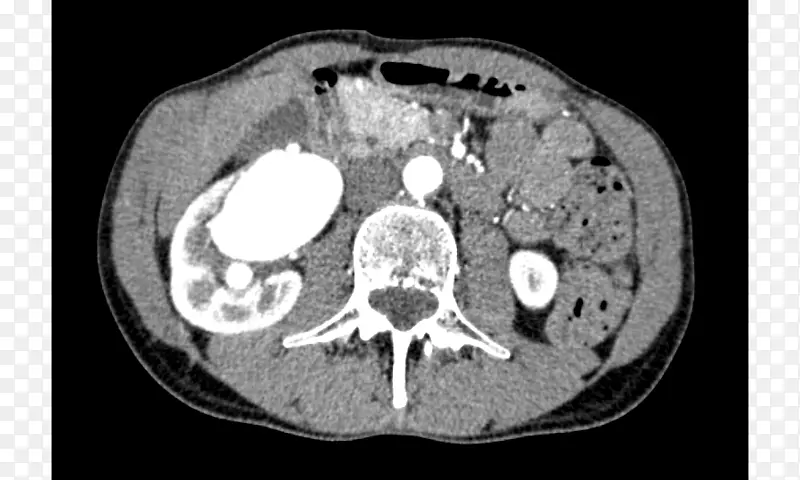 CTҽѧX����Ӱ������������-������