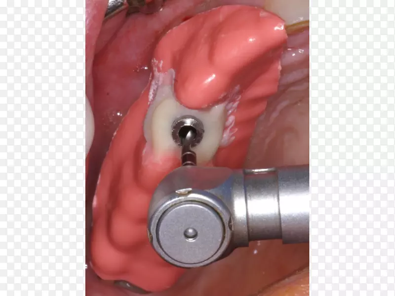 �꾮�����꾮��Ƶ��ָ��������-������