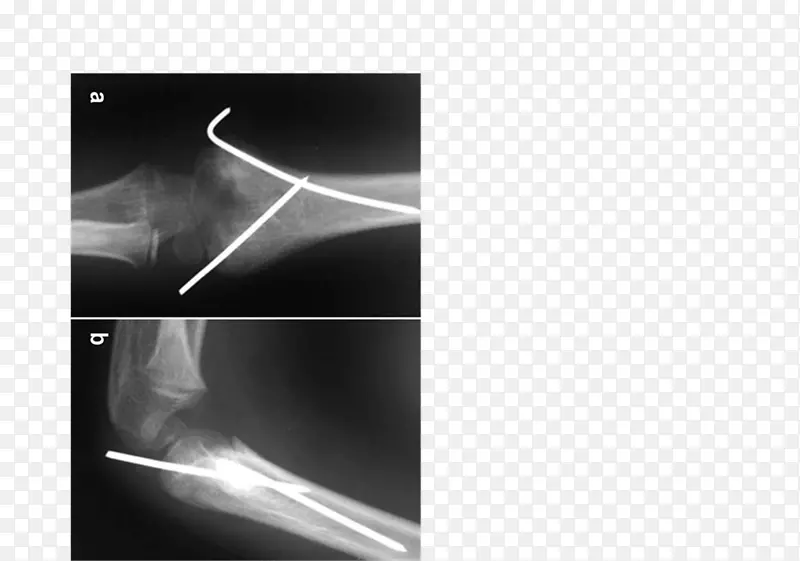 Ʒ�������ֽ��ɫ���-������