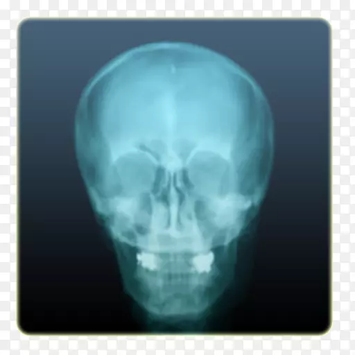 x�����Ů���ǿ���Ц˵android x�����Ӿ�-android-������