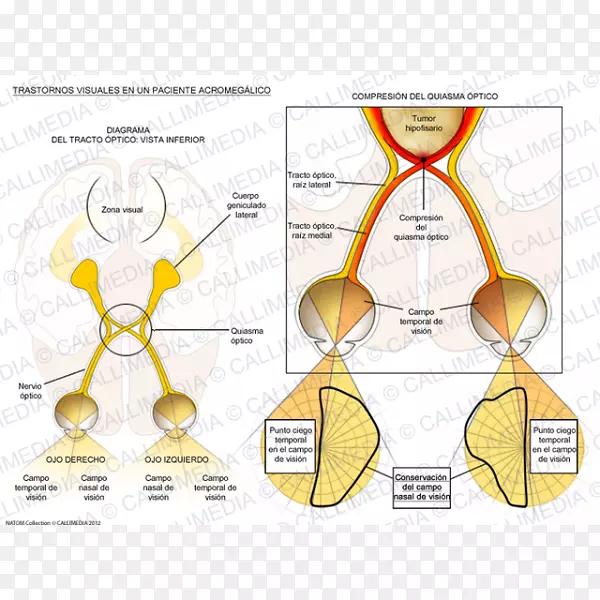 ֫�˷ʴ�֢����ֽ������Ϊ��֫�˷ʴ�֢-������