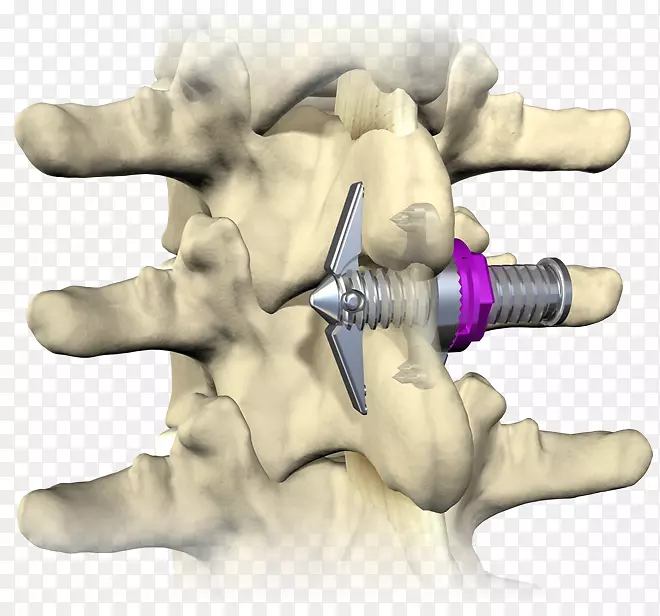 �Ƕ�����ָ-������