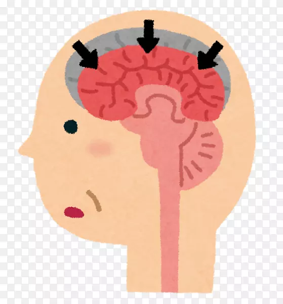 Ѫ���Գմ��ϲ�·���尢���ĺ�Ĭ����Ѫ�ܲ�-�����ĺ�Ĭ��-������