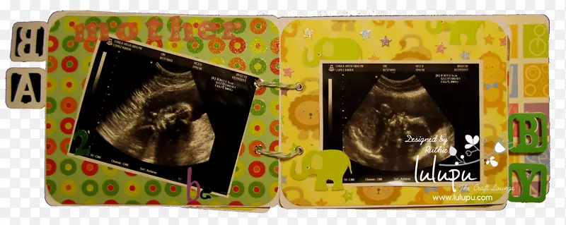 ��Ӥ����������ô˵���ʼǱ����������к�-������