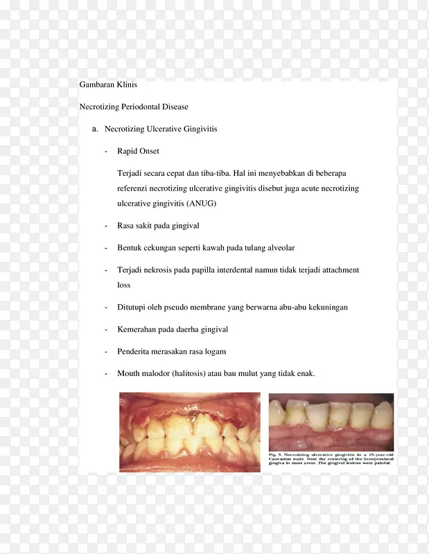 ʳ���°�-������