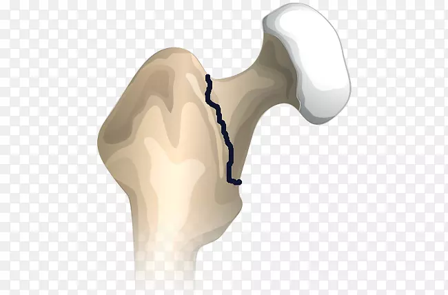 Ĵָ�μ����-������