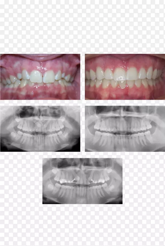 ����͢ɽǰ���������������-����˹�ոǴ�DMD-������