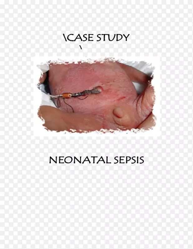 ��������Ѫ֢-������