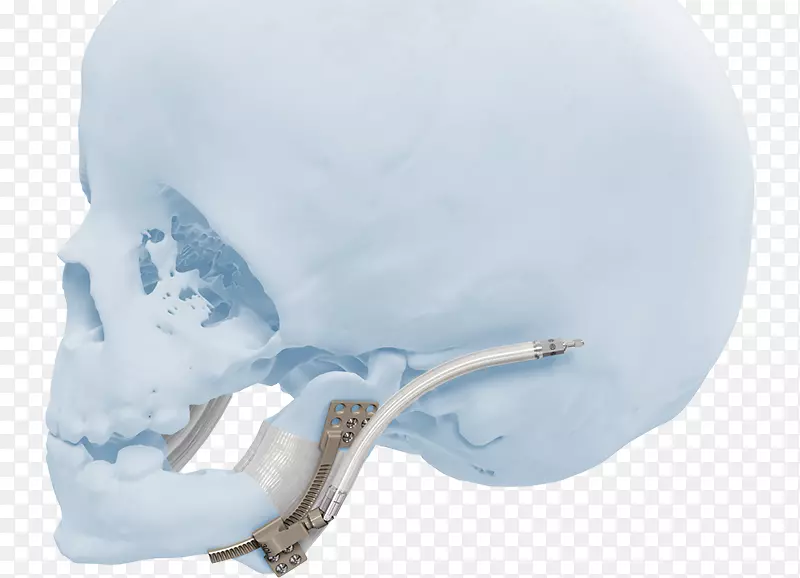 ͷ�ǲ�Ʒ���-������