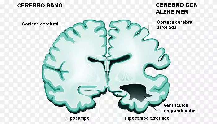 �����ĺ�Ĭ����Ĥ��ͼ������Ĥ��-������