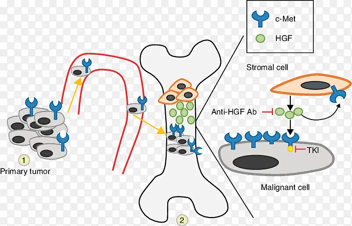 ǰ���ٰ� ת�� ��֢-������